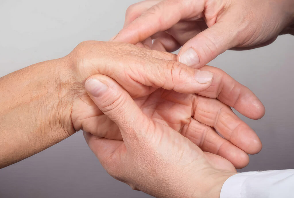 Лечение артрита – CBD (КБД)