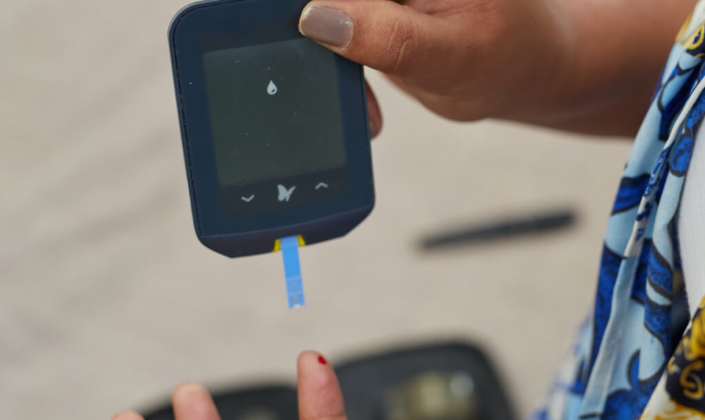 Широкий спектр действия средств на каннабидиола побуждает ученых к проведению углубленных исследований. Результаты клинических испытаний показывают, что данные продукты помогают при самых проблемных заболеваниях, включая сахарный диабет.Уникальность продуктов КБД заключается в механизме действия и внушительном спектре полезных свойств. Далее мы расскажем, как данные средства помогают в лечении диабета. Каннабиноиды для диабетиковПрямых доказательств того, что каннабис помогает вылечить данное заболевание, на сегодняшний день нет. И все же научные исследования подтверждают очевидную пользу каннабиноидов при диабете первого типа. Средства КБД способствуют снижению инсулина в количестве, требуемом пациенту для достижения оптимальных показателей сахара в крови.Ученые из Хадасской университетской больницы в Иерусалиме в рамках исследования, проведенного на лабораторных мышах, установили очевидную взаимосвязь между каннабисом и нормализацией уровня сахара в крови.Доказано, что умеренное потребление каннабидиола обеспечивает впечатляющий эффект:•	снижает уровень инсулина почти на 17%;•	понижает степень инсулинорезистентности на 18%;•	повышает уровни HDL-C;•	помогает снизить вес и уменьшить объем талии (актуально для пациентов с ожирением).Дополнительные исследования выявили благоприятное воздействие средств CBD относительно вторичных симптомов диабета. К таковым относятся тревожность, бессонница, депрессивные состояния, апатия, нарушения в работе ЦНС. Положительный эффект от применения масел и других продуктов КБД позволяет рассматривать их в качестве натурального нейропротектора и альтернативного антидепрессанта. В дальнейшем ученые планируют провести углубленные исследования каннабиноидов в вопросах лечения диабетической ретинопатии и заболеваний сердца.На заметку: в настоящее время клинические испытания в отношении влияния КБД на уровень инсулина продолжаются. Ученые намерены конкретизировать степень эффективности каннабидиола и определить наиболее действенные механизмы применения вещества в профилактике и лечении диабета. Официальные исследованияСогласно результатам масштабных клинических испытаний, каннабидиол прямо показан пациентам с сахарным диабетом 1-го типа. Вещество и продукты на его основе являются эффективными средствами профилактики осложнений, способных провоцировать развитие патологии. К примеру, каннабидиол препятствует повреждению кровеносных сосудов и вен, на что указывают выводы исследований Вайсс (2006), Стенли (2013), Охки (2010), Лиу (2009). Приведем основные тезисы из научных трудов:•	Каннабиноиды оказывают благоприятное воздействие на механизмы, тесно связанные с развитием сахарного диабета.•	Каннабидиол помогает в снижении уровня глюкозы, смягчает воспалительные процессы, провоцирующие диабет.•	Продукты на основе КБД способствуют улучшению функционирования поджелудочной железы, ответственной за выработку инсулина.•	Вещество увеличивает численность и активность бета-клеток, производящих инсулин. Это позволяет сделать вывод о положительном влиянии CBD на глюкозный обмен.В исследовании Стенли (2013) говорится, что эндоканнабиноиды можно рассматривать в качестве модернизированной версии эндотелинной вазорелаксации – процедуры, расширяющей кровеносные сосуды. ПреимуществаTheCBD.ru – производитель единственной сертифицированной в России продукции на основе каннабидиола. В ассортименте компании представлены полностью натуральные продукты с доказанной эффективностью в профилактике и лечении сахарного диабета. Мы гарантируем:•	Контроль качества на всех этапах производства.•	Квалифицированную помощь в подборе подходящего продукта.•	Соответствие действующим стандартам качества и безопасности.Средства на основе каннабиноидов удобны в применении, на 100% экологичны и безопасны для вашего здоровья. Доставка товаров возможна по всей России и СНГВ разделе «Эксперты» на нашем сайте https://thecbd.ru/experts/ представлены специалисты, использующие в своих протоколах продукцию с CBD. В профилях экспертов Вы можете ознакомиться с профессиональным мнением о терапевтических свойствах каннабидиола (КБД), а также связаться с ними для получения консультации по интересующим Вас вопросам.